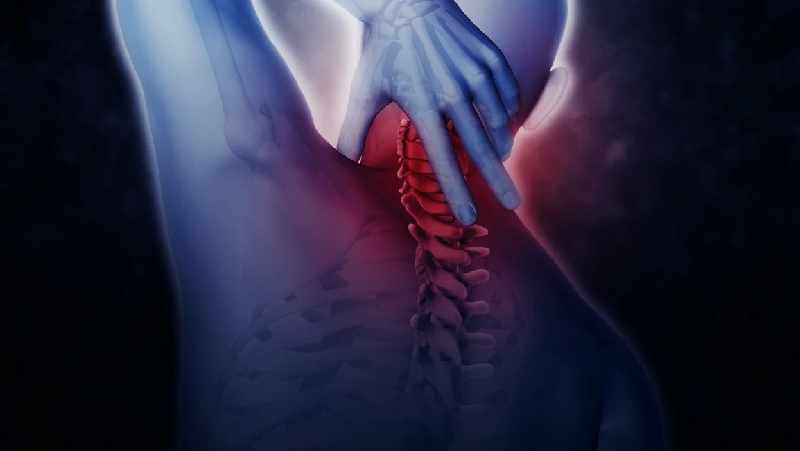 dor crônica cannabis APEPI