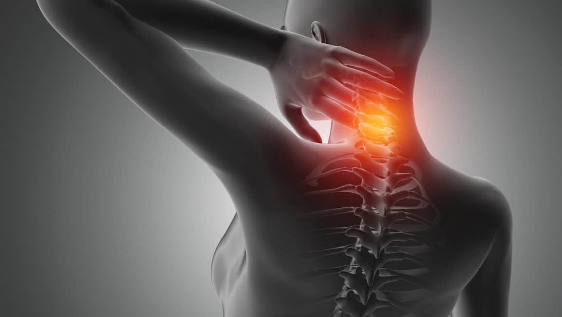 Ilustração 3D de figura humana com dor cervical destacada em laranja e vermelho, representando a dor crônica tratada com cannabis para fibromialgia